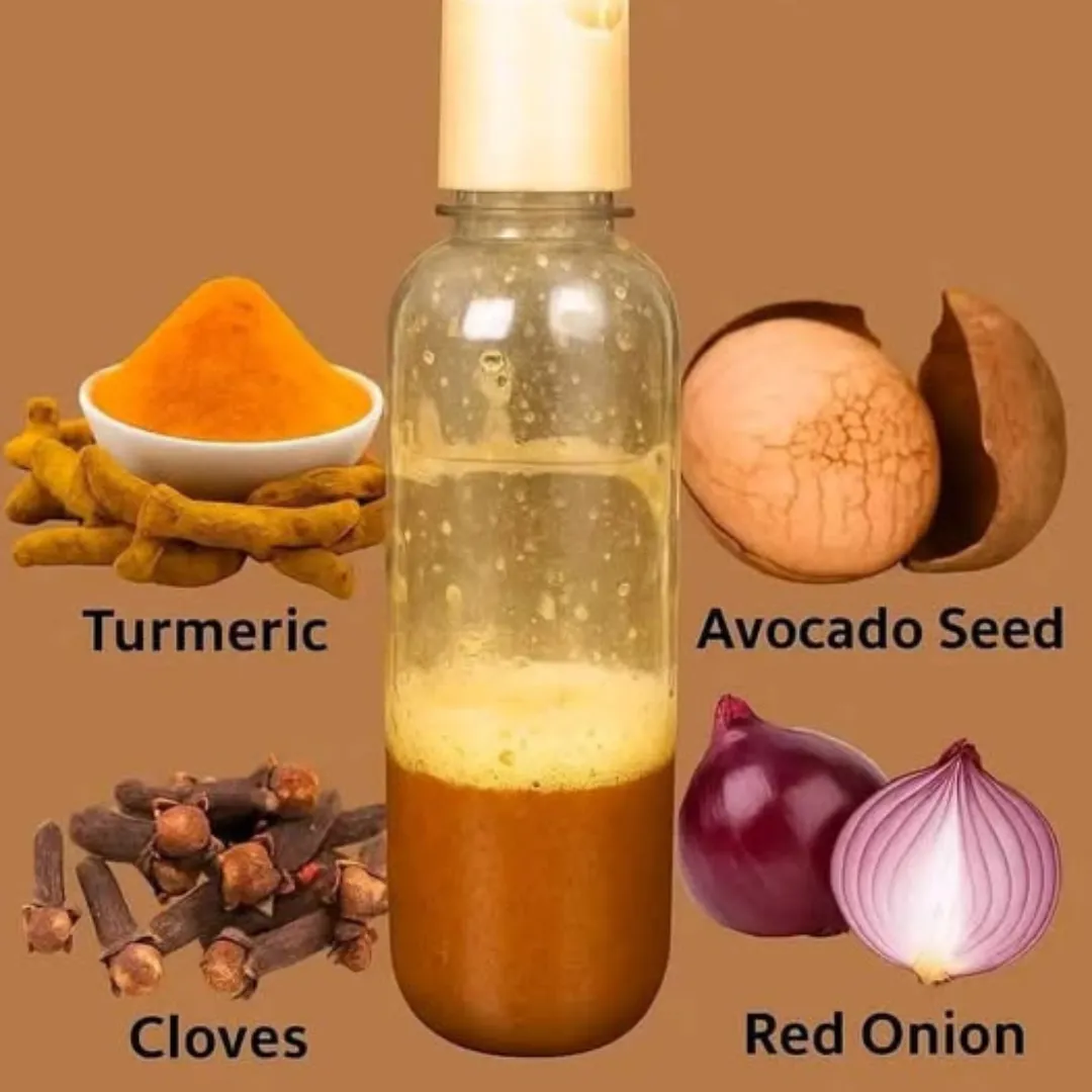 What are some over-the-counter treatments for bald spots?